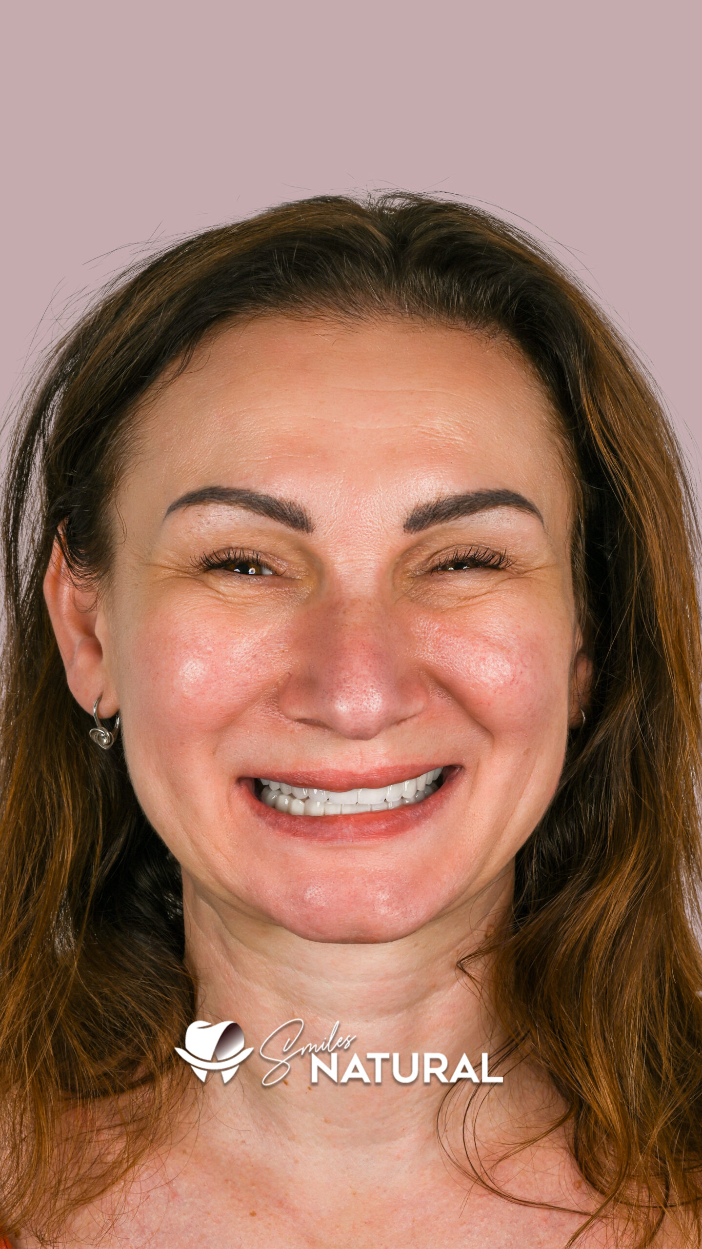 natural-2