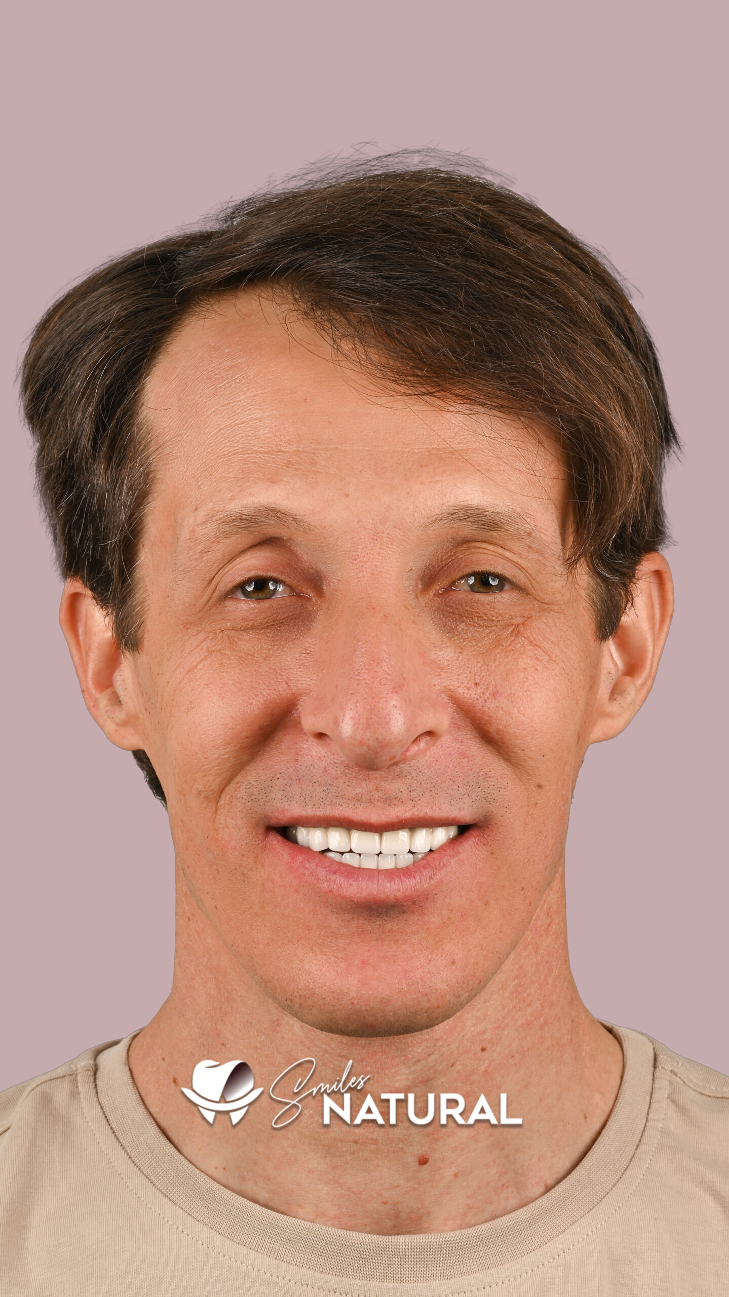 natural-3
