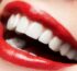 All-on-8 Dental Implants in Antalya Cost