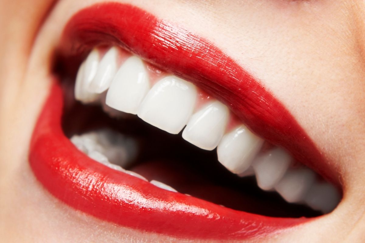 All-on-8 Dental Implants in Antalya Cost
