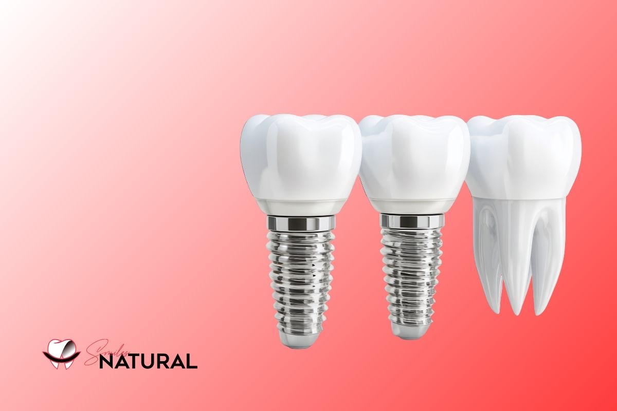 All on four dental implant in antalya